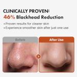 Hanskin BHA Pore Cleansing Oil for Oily Skin