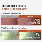 Hanskin BHA Pore Cleansing Oil for Oily Skin