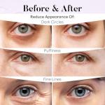 BLOOMORA Hydrating Eye Patches for Tired Eyes