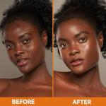 OAKDOLCHE Turmeric Kojic Acid Soap Bars Pack