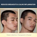 Dead Sea Sulfur Soap with Olive Oil - Vegan Bar