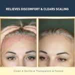 Dead Sea Sulfur Soap with Olive Oil - Vegan Bar