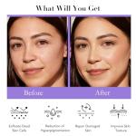 5-in-1 Daily Skincare Set with Glycolic Acid