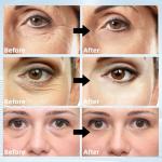 60Pcs Retinol Hydrogel Eye Patches for Puffiness