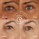 Skyn ICELAND Cooling Under Eye Patches - 8 Pairs