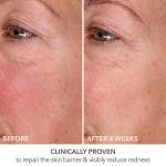 Dr. Dennis Gross Fill + Repair Serum, 1 oz