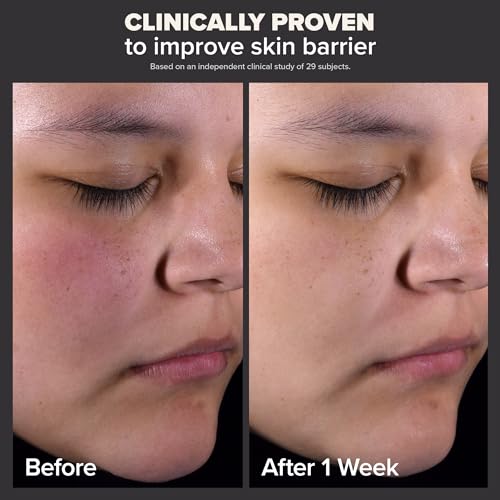 Organic Makeup: 2% BHA Liquid Salicylic Exfoliant