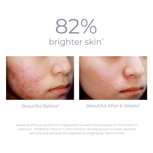 DERMA-E Vitamin C Hydrating Day Cream - Brightening