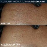 RoC Retinol Correxion Daily Hydration Anti-Aging Moisturizer