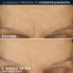 RoC Retinol Correxion Daily Hydration Anti-Aging Moisturizer