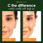 Tree of Life Vitamin C Skin Care Set