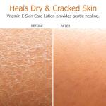 Fruit of the Earth, Vitamin E Lotion, 16 oz