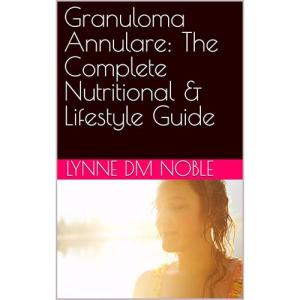 Granuloma Annulare: The Complete Nutritional & Lifestyle Guide