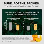 HojaSana Saw Palmetto for Men Prostate Health Supplement, Pharmaceutical Grade - DHT Blocker - Graminex | Pumpkin Seed Oil | Nettle Supports Urinary Function & Hair Loss Prevention, 60 softgels