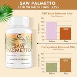 Gesundgeist Saw Palmetto for Women Hair Loss - DHT Blocker with 5-in-1 Blend for Hair Growth, Skin & Nails, Urinary Wellness - Extra Strength Saw Palmetto Supplement - 180 Capsules