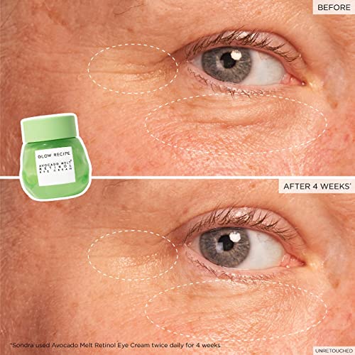 Avocado Retinol Eye Cream: Dark Circles, Wrinkles, Brightening