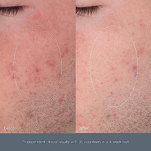 Dermalogica Daily Microfoliant Face Exfoliator Scrub Powder