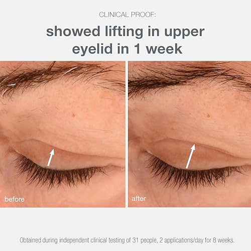 Dermalogica Phyto Nature Lifting Eye Cream - Wrinkle Reduction