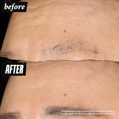 Kiehl's Super Multi-Corrective Face Moisturizer for Aging Skin