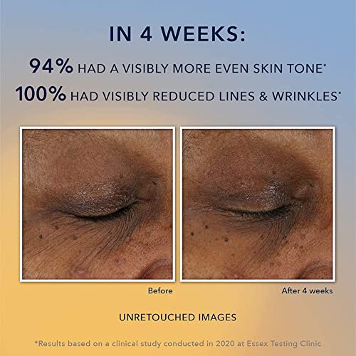 RoC Vitamin C Serum - Daily Anti-Aging Treatment