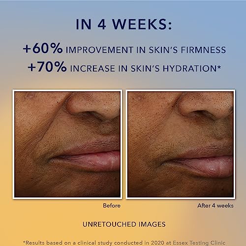 RoC Vitamin C Anti-Aging Gel Cream Face Moisturizer