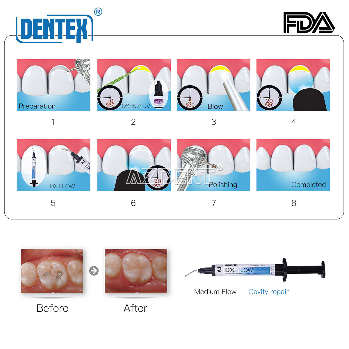 DENTEX Dental Flowable Light Cure Composite Resin Medium Flow A1/A2/A3 3g USA