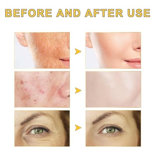 Advanced Snail Mucin 96% Power Repairing Essence, Snail Mucin Serum,With Snail Secretion Filtrate,for Dull Skin & Fine Lines (1pcs100ml/)