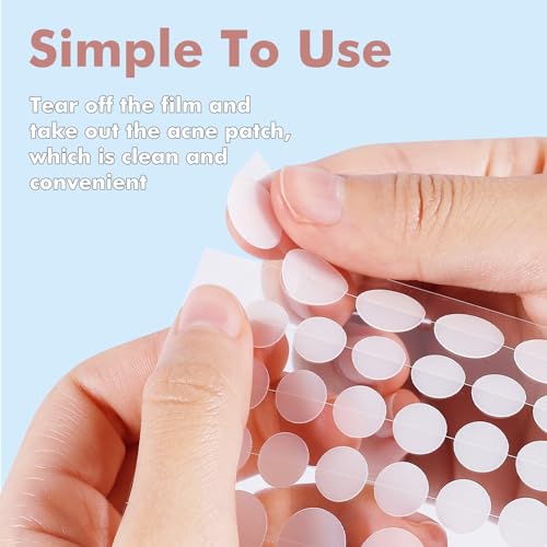 sundpik Pimple Patches for Face 304pcs,Hydrocolloid Acne Patches Star,Zit Patches,Pimple Popper Tool Kit,Facial Skin Care Products Containing Salicylic Acid,Tea Tree Oil and Calendula Oil(304)
