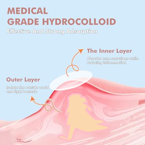 sundpik Pimple Patches for Face 304pcs,Hydrocolloid Acne Patches Star,Zit Patches,Pimple Popper Tool Kit,Facial Skin Care Products Containing Salicylic Acid,Tea Tree Oil and Calendula Oil(304)