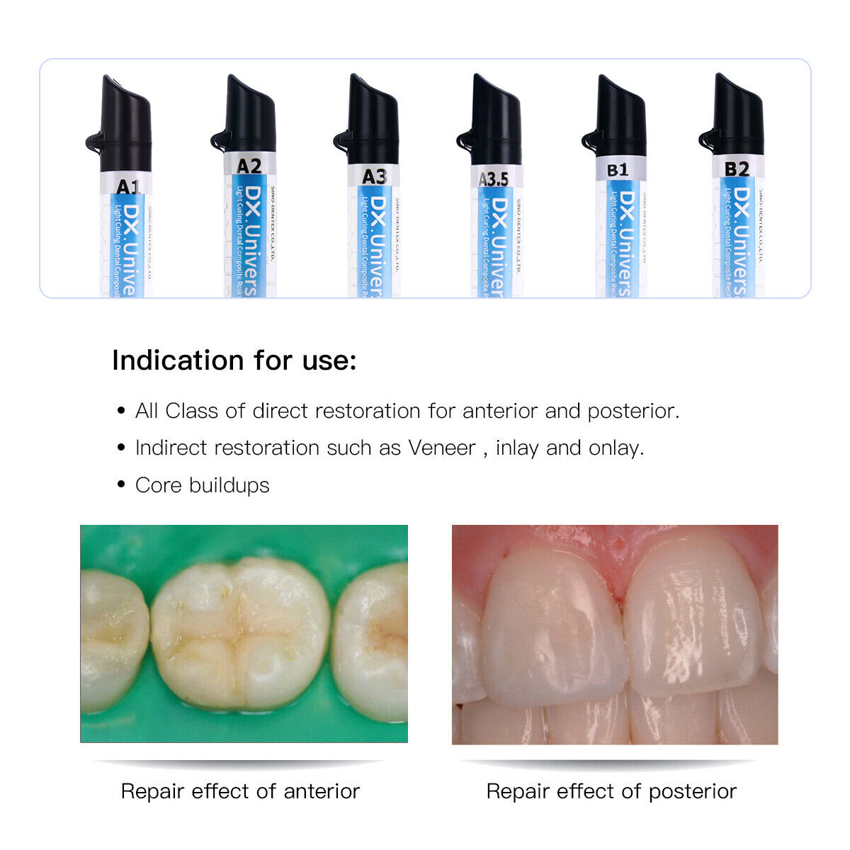 DENTEX Universal Dental Light Cure Hybrid Composite Resin A1/A2/A3/A3.5/B1