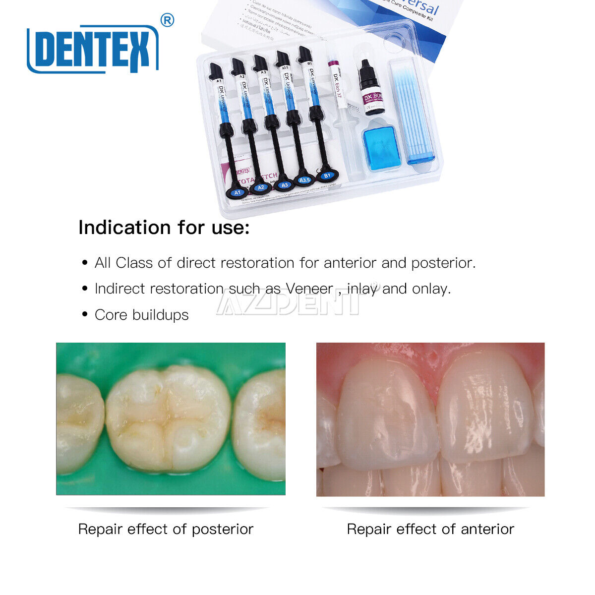  DENTEX Universal Dental Light Cure Composite Resin Kit A1 A2 A3 A3.5 B1