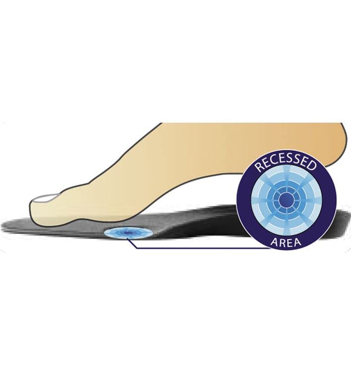 DonJoy Arch Rival Orthotic Inserts, 1 Pair, Size C (Shoe Size: Men's 7.5-9 / Women's 8.5-10)