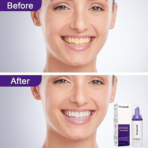 Purple Whitening Toothpaste, Stain Removal Foam Kit (50ml)