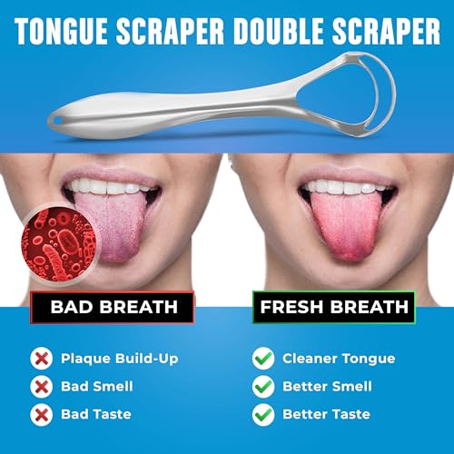 BASIC CONCEPTS Tongue Scraper for Adults (2 Pack), Reduce Bad Breath (Travel Cases Included), Stainless Steel Tongue Cleaners, 100% Metal Tongue Scraper with Case Fresh Breath Tongue Cleaner Oral
