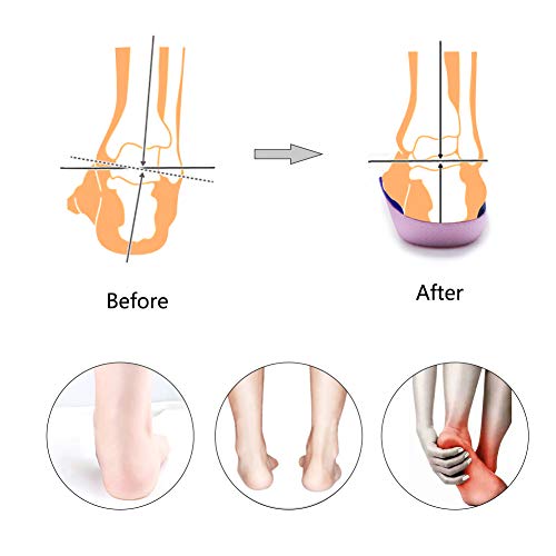 PCSsole’s 3/4 Orthotics Shoe Insoles High Arch Supports Shoe Insoles for Plantar Fasciitis, Flat Feet, Over-Pronation, Relief Heel Spur Pain