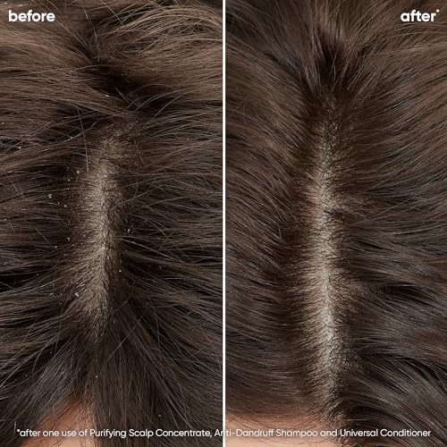 Biolage Scalp Sync Universal Conditioner | Lightweight Conditioner For All Scalp Types | Paraben & Sulfate Free | For Sensitive Scalps | Vegan & Cruelty Free | Salon Shampoo