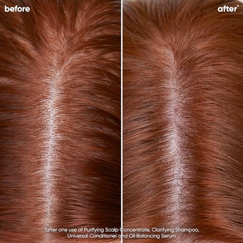 Biolage Scalp Sync Oil Balancing Serum | Absorbs & Reduces Excess Oil | For Oily Scalp | Paraben & Silicone-Free | Vegan | Cruelty Free | Lightweight Leave-In Serum For Oil Reduction