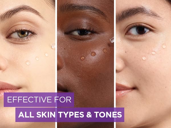 L Oreal Paris Serum Revitalift Filler [+Hyaluronic Acid], 1.5% Pure Concentrated Hyaluronic Acid Dropper Serum