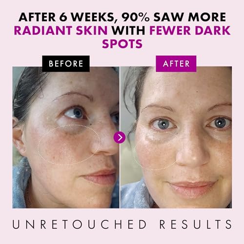 Collagen Anti Aging Face Cream with Patented Matrixyl-3000 & Argireline - 5x More Powerful w/ Pep-Boost Peptide Complex + 10 Antioxidants - Facial Wrinkle Day/Night Cream Face Moisturizer for Women