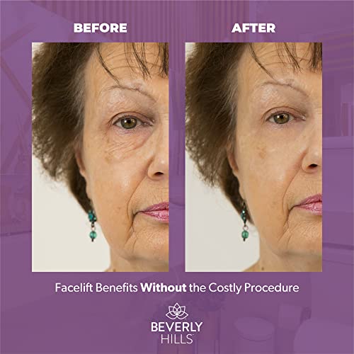 Beverly Hills Instant Facelift Anti Aging Eye Serum Treatment for Dark Circles, Puffy Eyes, Wrinkles, Under Eye Bags, Fine Lines, and Crows Feet | 30mL (120 Days Supply)