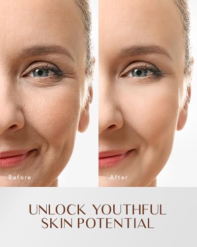 EnaSkin Retinol Face Moisturizer Collagen Cream, Rapid Wrinkles Repair, Day/Night Anti-Aging Facial Cream for Women & Men, Max. Hydration &Fight Fine Lines, 1.7 fl oz.