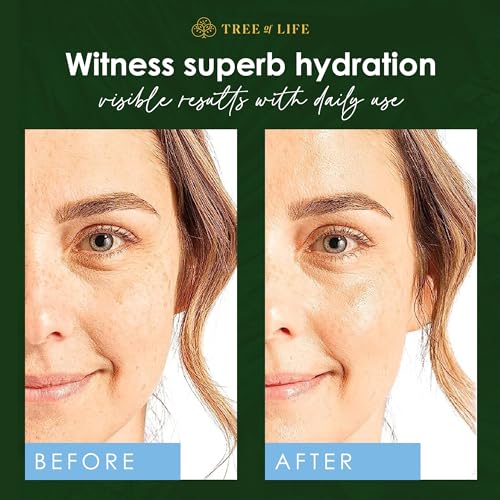 Tree of Life Hyaluronic Acid Serum, Skin Brightening Face Oil for Dark and Age Spots, Facial Serums for Dry and Sensitive Skin Care with Vitamin E for Soft Smooth Skin, 2 Fl Oz