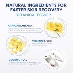 Arnica Bruise Cream Extra Strength: Fast-Acting for Bruising & Swelling on Thin Skin - High Strength Arnica Montana with Vitamins K, C & E–Hydrating Moisturizer for Face & Body 4 oz