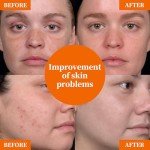 Premium Vitamin C 20% Serum For Face with Hyaluronic & Amino Acids - Boost Skin Collagen, Hydrate & Plump Skin, Anti Aging & Wrinkle Facial Serum – 1 Fl Oz