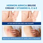 Arnica Bruise Cream Extra Strength: Fast-Acting for Bruising & Swelling on Thin Skin - High Strength Arnica Montana with Vitamins K, C & E–Hydrating Moisturizer for Face & Body 4 oz