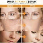 Super Vitamin C Serum for Women Over 70: Advanced Anti-Aging Vitamin C, Niacinamide, Vitamin E & Caffeine Formula，Hydrates, Firms, Lifts, Targets Wrinkles & Dark Spots, 1.0 fl. oz.