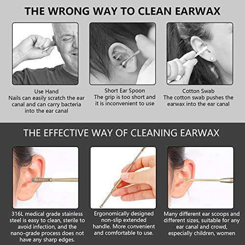 Hion 6 Pcs Ear Wax Removal Kit,Professional Double-Headed Ear Pick Earwax Removal Tools,316L Stainless Steel Ear Cleaner Curette with Cleaning Brush and Storage Box,Suit for Kid Adult(Gold)