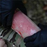 RHINO RESCUE Complete Burn Relief Kit