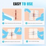 Butterfly Bandages - 4-Piece Laceration Kit