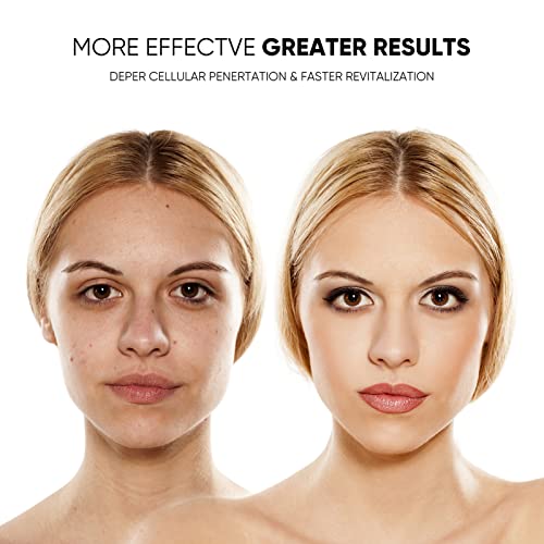 GOHIGK LED Face Mask - Photon Beauty Device